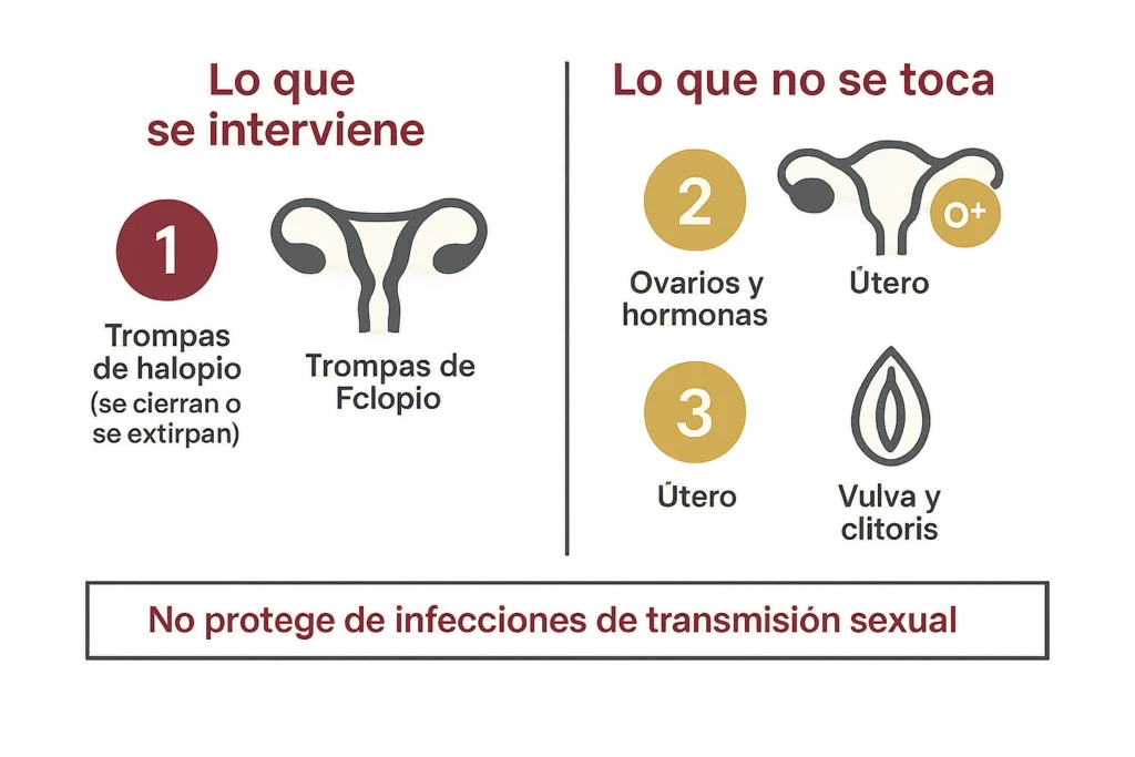 Esquema en dos columnas: trompas de Falopio marcadas como intervenidas y ovarios, útero